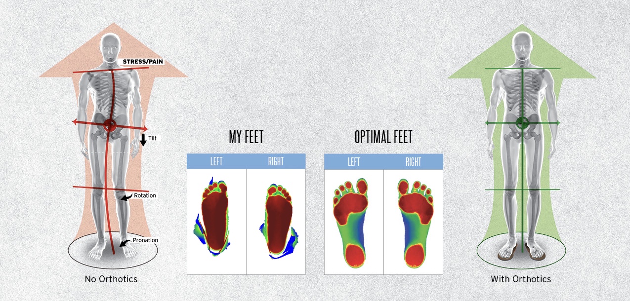 Functional Feet | White Plains, NY Chiropractor | Vinh Tran, DC, CCSP